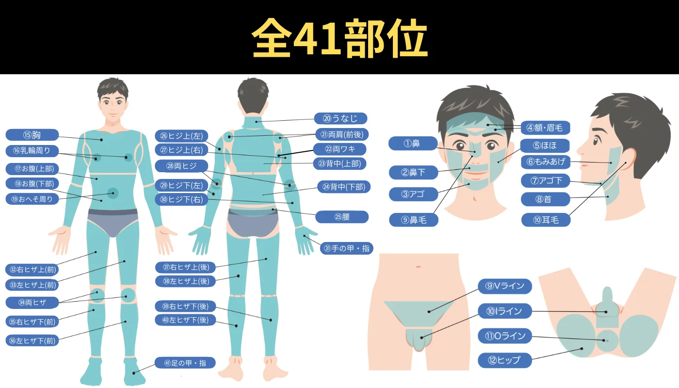 全41部位